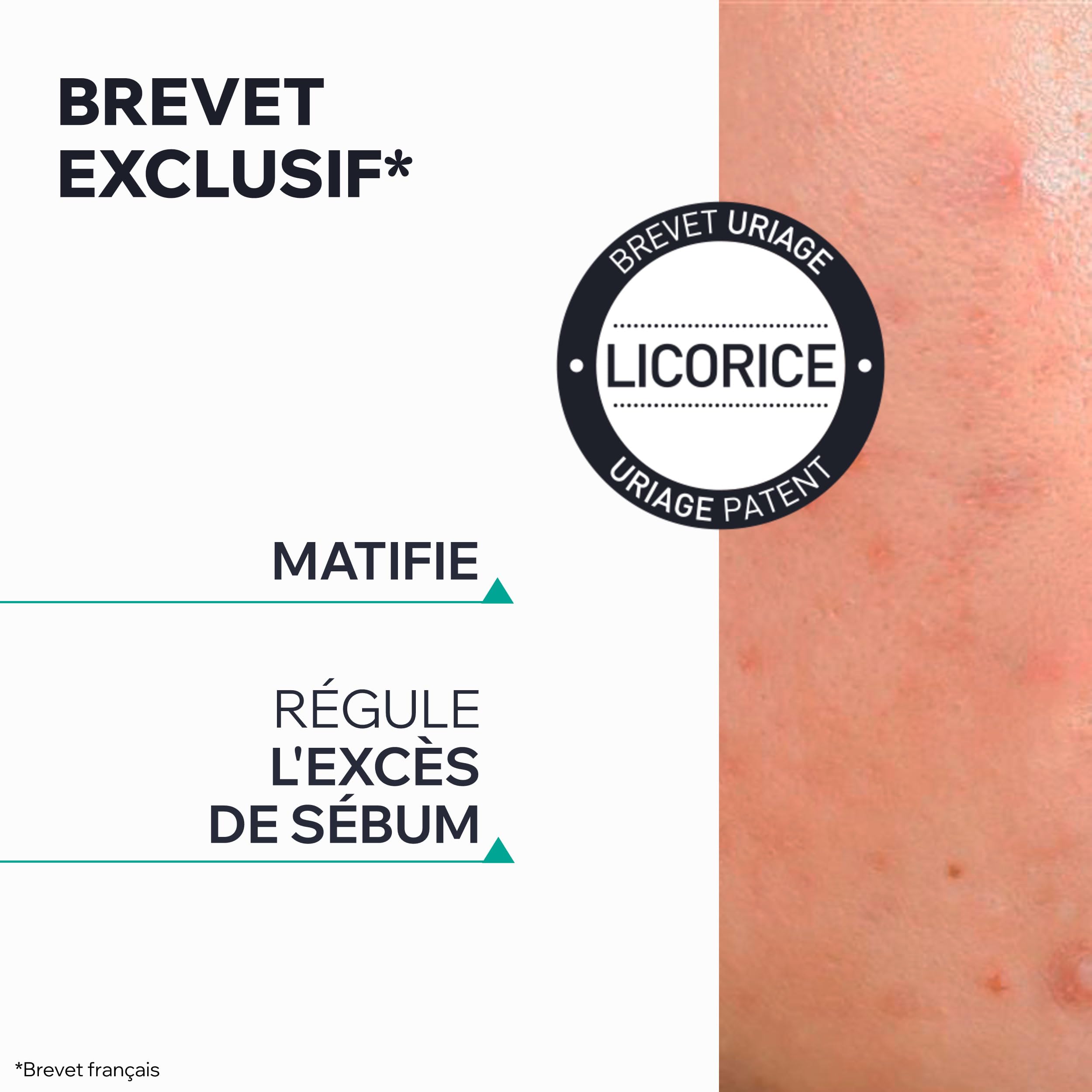 uriage-hys-ac-p-te-sos-15-g-argile-verte-zinc-arbre-th-soin-local-anti-imperfect image 5