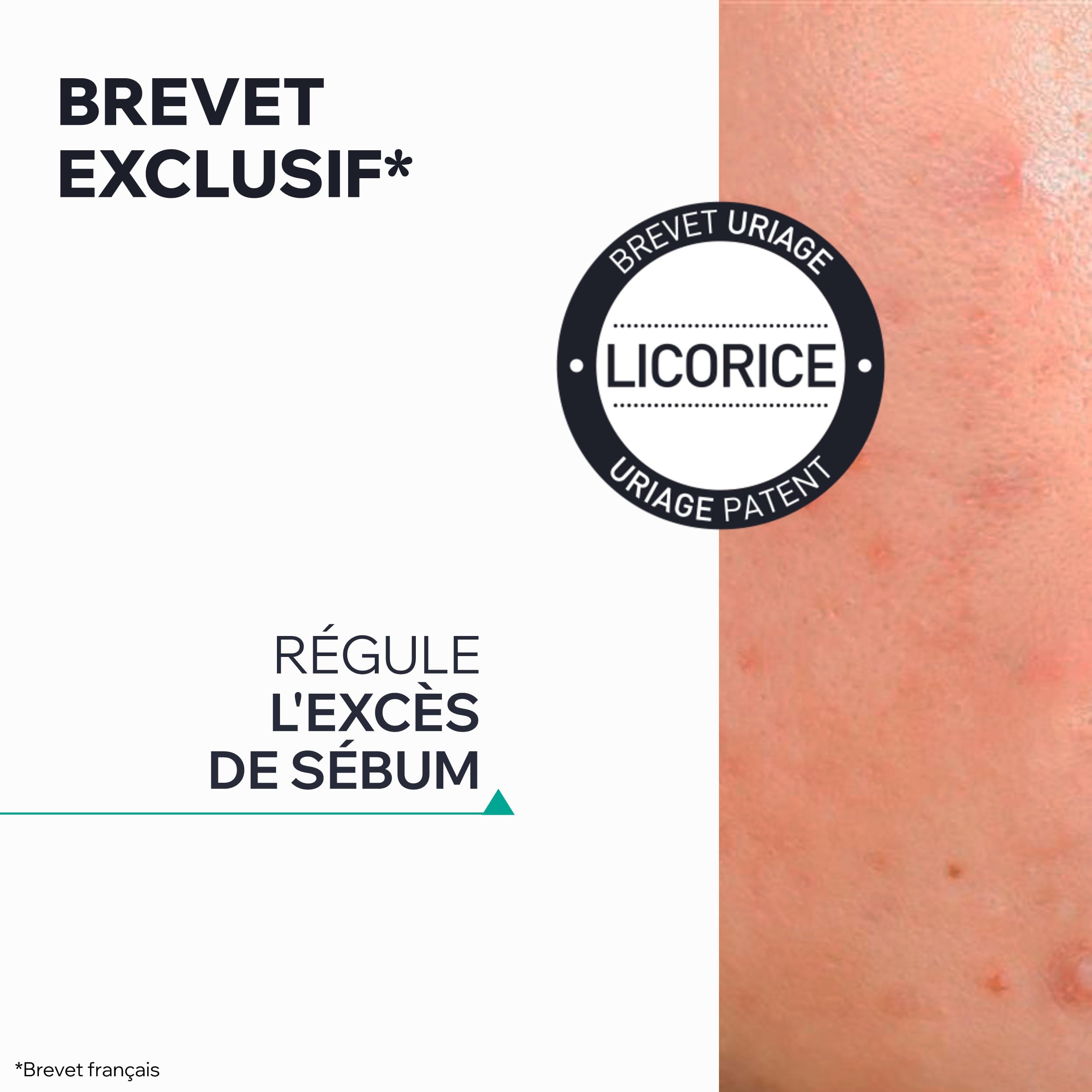 uriage-hyseac-gel-sos-ass-chant-5-7-aha-bha-soin-localis-anti-imperfections-effe image 5