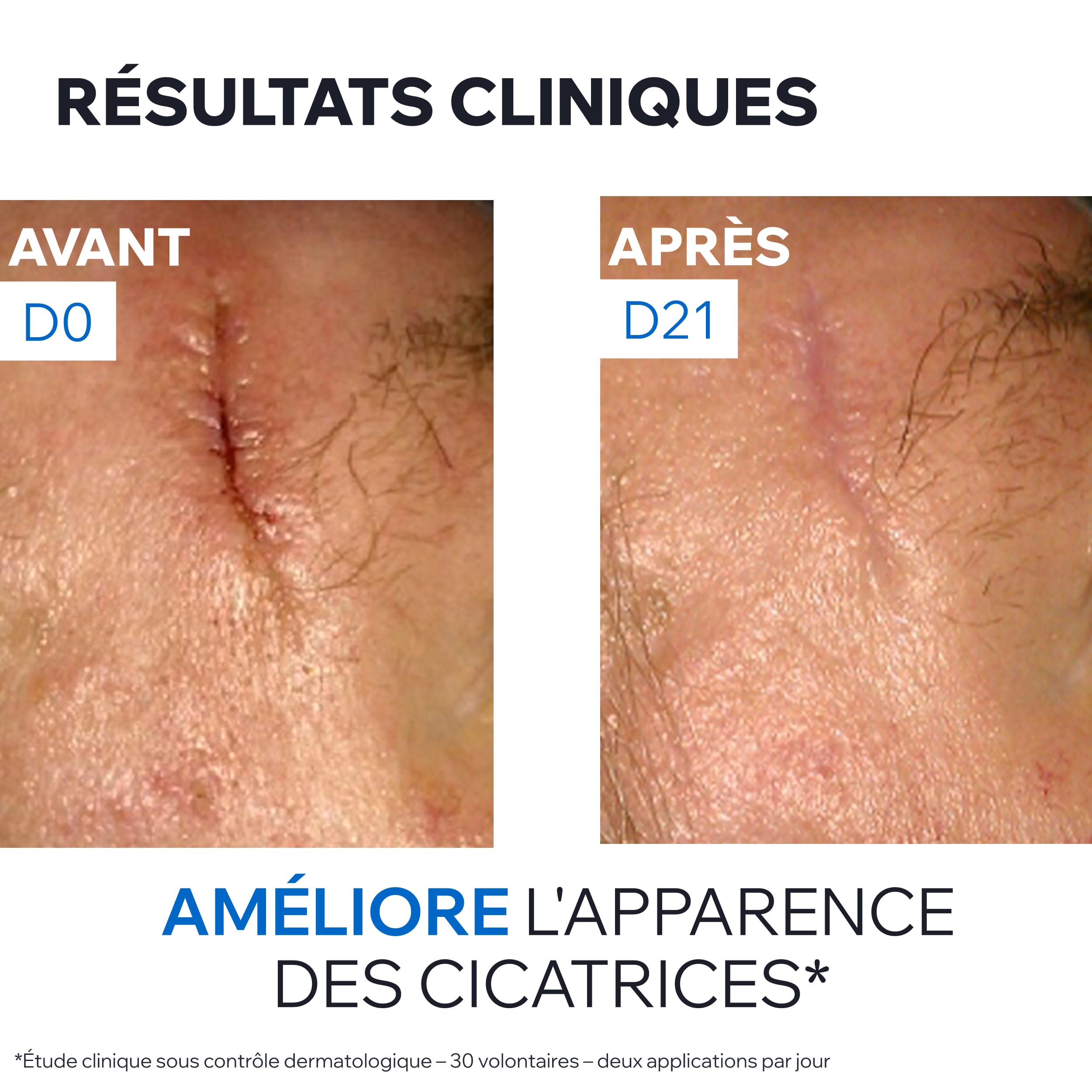 uriage-bari-derm-cica-cr-me-r-paratrice-cuivre-zinc-40-ml-multi-usages-visage-et image 6