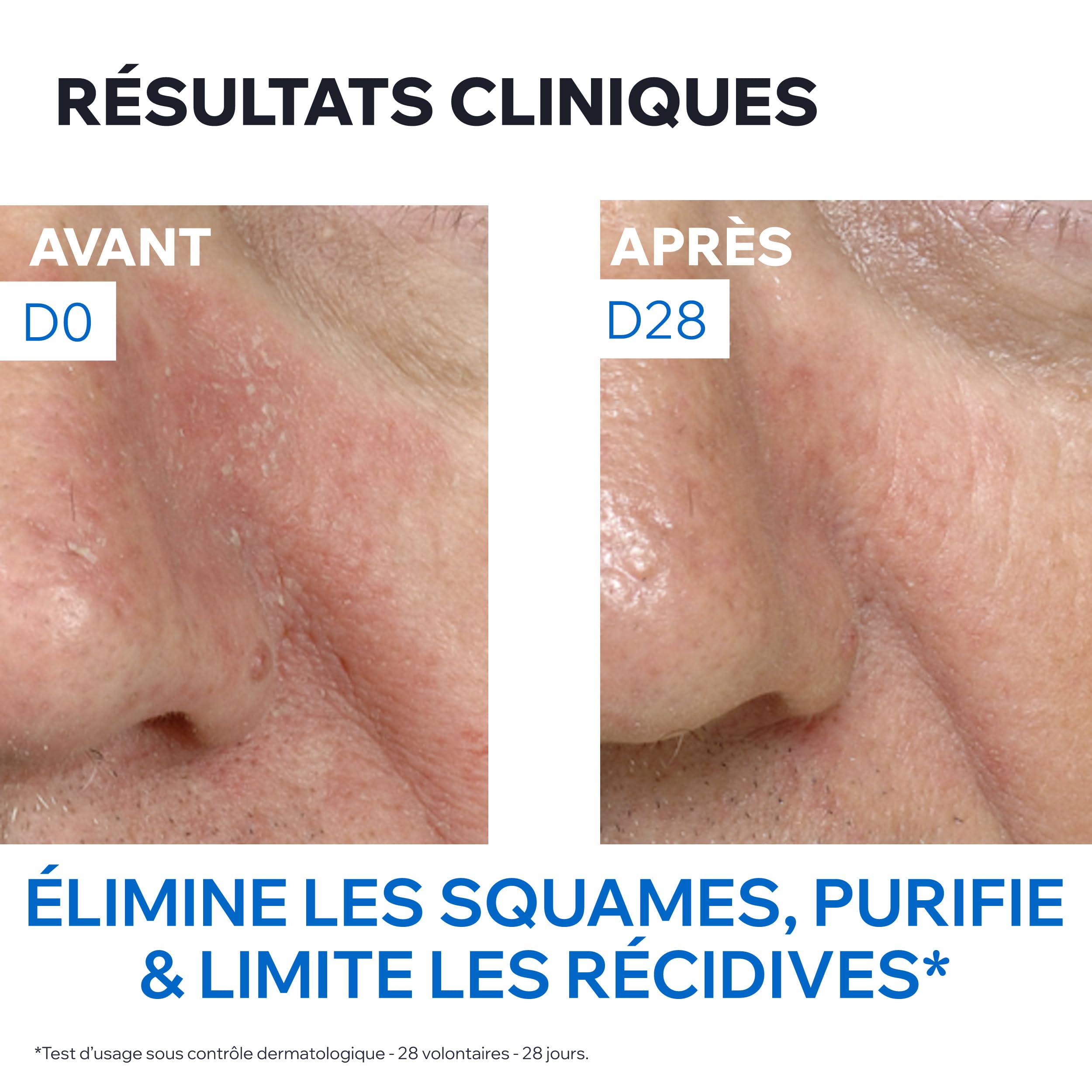 uriage-ds-mulsion-apaisante-r-gulatrice-40ml-glyc-rine-beurre-de-karit-r-duit-sq image 6