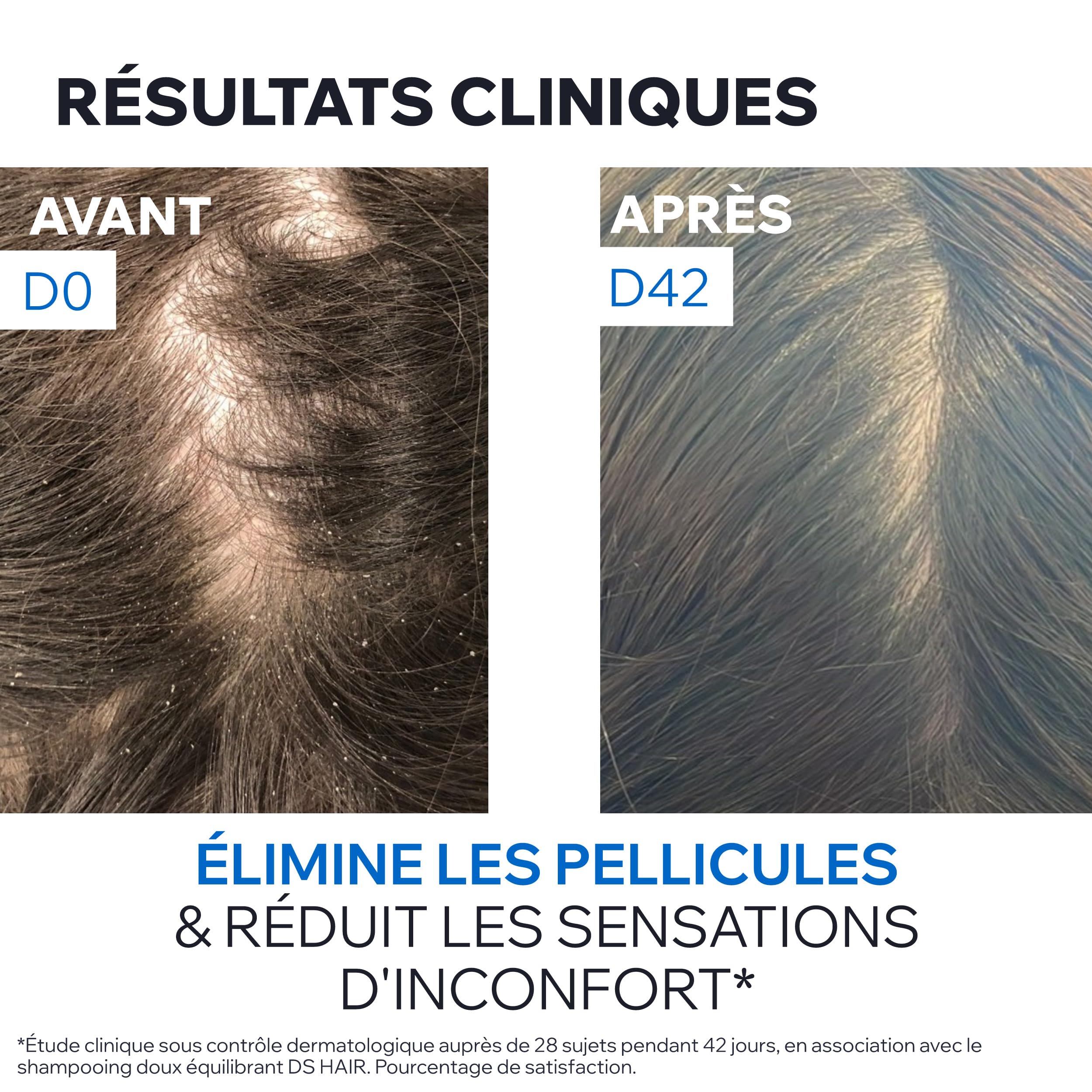 uriage-ds-hair-shampooing-traitant-antipelliculaire-200-ml-piroctone-olamine-zin image 7