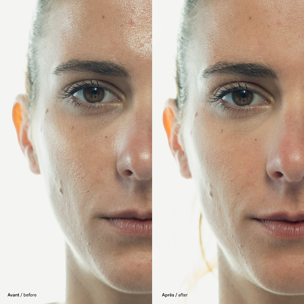 typology-gommage-visage-imperfections-soufre-2-extrait-d-ortie-96-d-origine-natu image 5